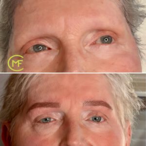 powderbrows-vorher-nachher-1 powderbrows-vorher-nachher-1